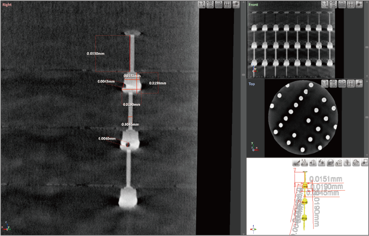 Röntgenbild des Rückfahrkamera-Moduls